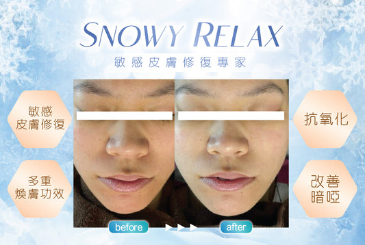 ❄️雪膚肌snowy relax❄️敏感皮膚修復專家