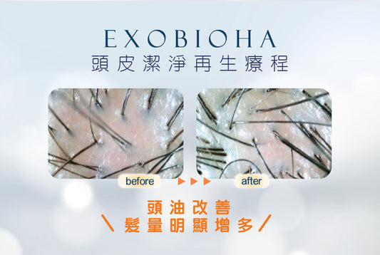 【 頭皮潔淨再生療程💆🏻‍♂️✨💆🏻‍♀️ 】